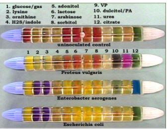 enterobacter aerogenes test results|8.2: Introduction to Bacterial Identification using Enterotube test.